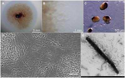 Characteristics of a lipase ArEstA with lytic activity against drug-resistant pathogen from a novel myxobacterium, Archangium lipolyticum sp. nov.